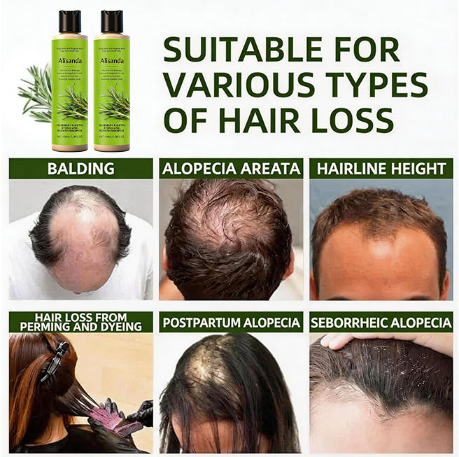 🔥LAST DAY 50% OFF - 🎅Alisanda® Organic Rosemary Hair Growth Shampoo