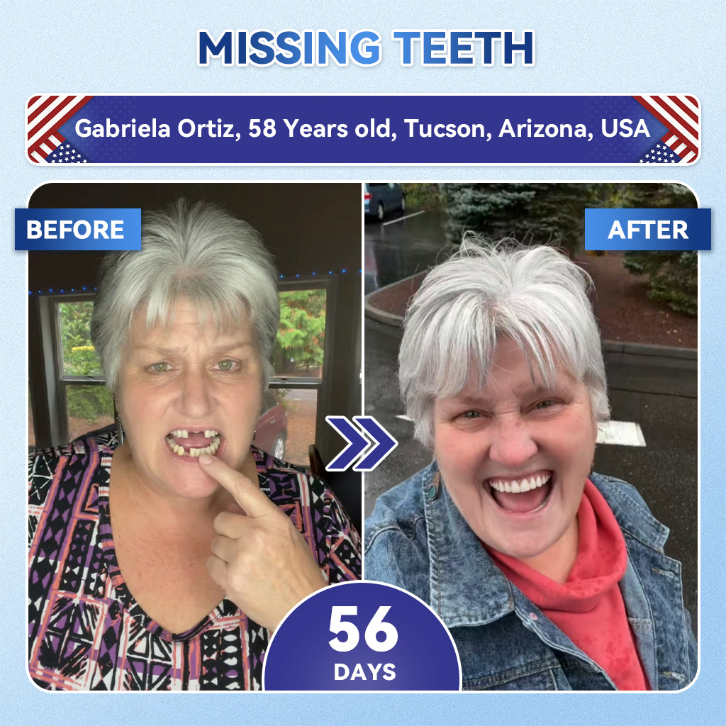SmileFitPro® 🦷 Tideglusib Fast‑Dissolving Tooth & Gum Repair Oral Strips ✨