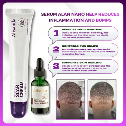 Alisanda Scar Cream – Advanced Treatment for Raised & Keloid Scars