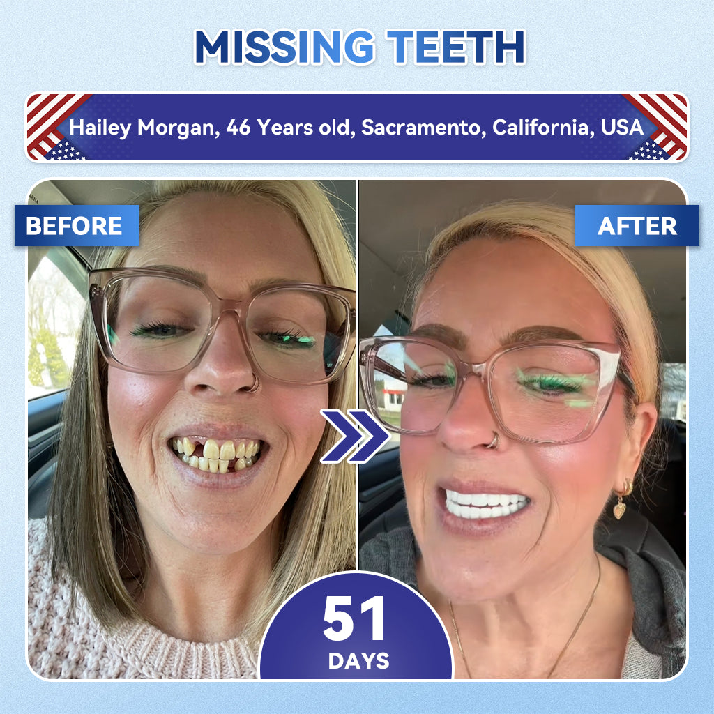 SmileFitPro® 🦷 Tideglusib Fast‑Dissolving Tooth & Gum Repair Oral Strips ✨