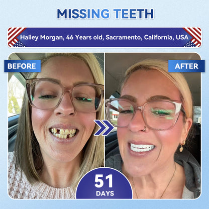 SmileFitPro® 🦷 Tideglusib Fast‑Dissolving Tooth & Gum Repair Oral Strips ✨