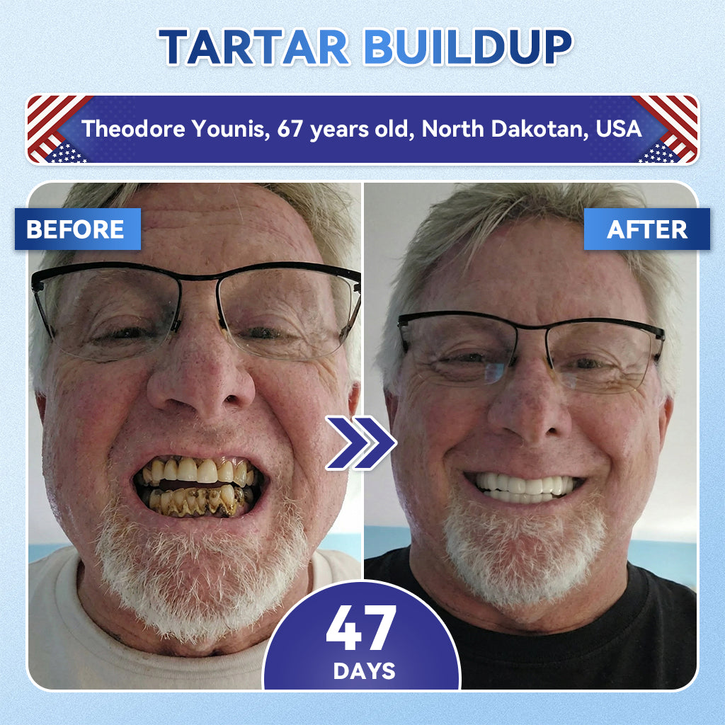 SmileFitPro® 🦷 Tideglusib Fast‑Dissolving Tooth & Gum Repair Oral Strips ✨