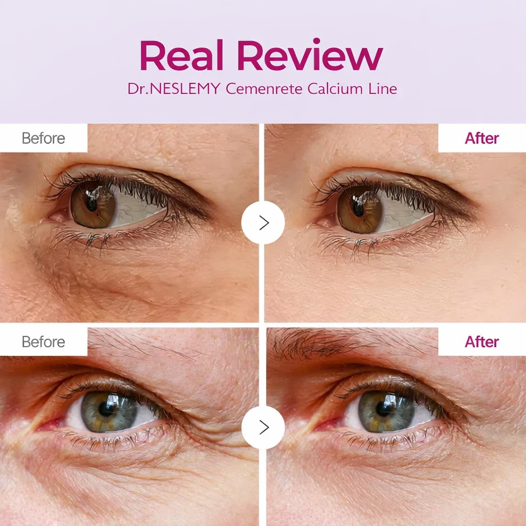CalmRestore Calcium Eye Lift Patches