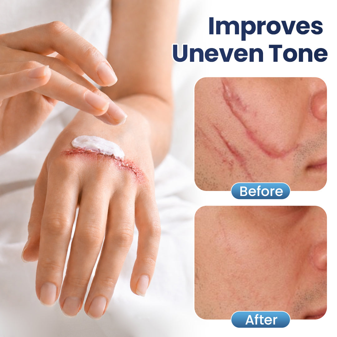 💥50% OFF💥Juxek® Texture Repair Gel