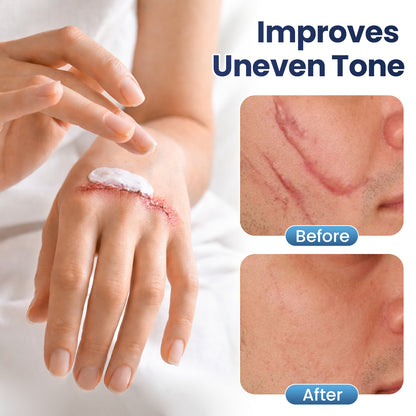 💥50% OFF💥Juxek® Texture Repair Gel