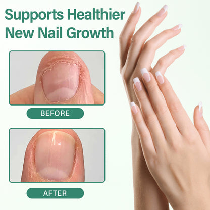 Medazy® Nail Detox Penetration Serum Pen