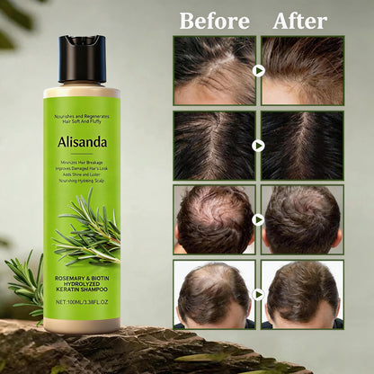 🔥LAST DAY 50% OFF - 🎅Alisanda® Organic Rosemary Hair Growth Shampoo