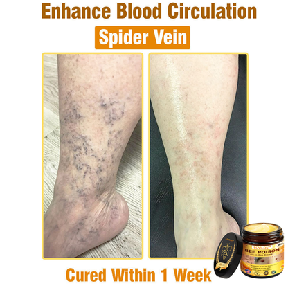 （🔥LAST DAY SALE-80% OFF)🥇👩‍⚕️LOVILDS™ Bee Poison All-in-One Cream US Dermatologist Approved 👨‍⚕️