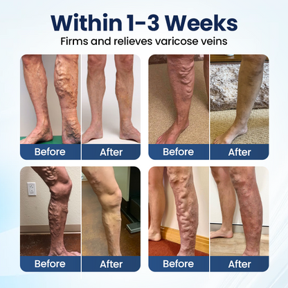 Vaxflite® Deep Vein Repair Microneedle Patch
