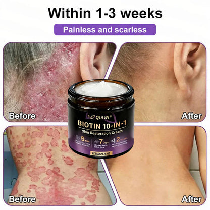 ✨Made and Shipped from USA ✨QIAWI® Biotin 10-in-1 Skin Restoration Cream 🍀