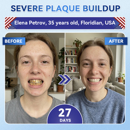 SmileFitPro® 🦷 Tideglusib Fast‑Dissolving Tooth & Gum Repair Oral Strips ✨