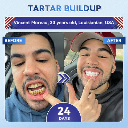 SmileFitPro® 🦷 Tideglusib Fast‑Dissolving Tooth & Gum Repair Oral Strips ✨