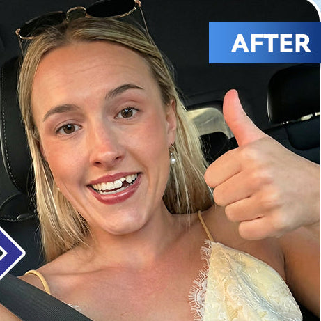 SmileFitPro® 🦷 Tideglusib Fast‑Dissolving Tooth & Gum Repair Oral Strips ✨