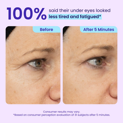 NEW! Instant Lift Eye Gel — Reduce the Look of Eye Bags in Minutes