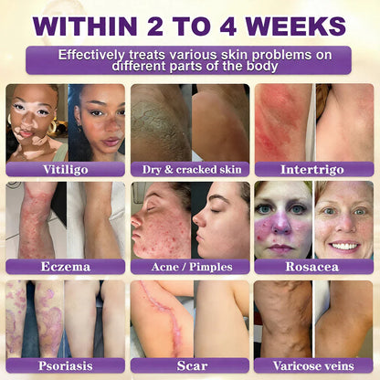 ✨Made and Shipped from USA ✨QIAWI® Biotin 10-in-1 Skin Restoration Cream 🍀