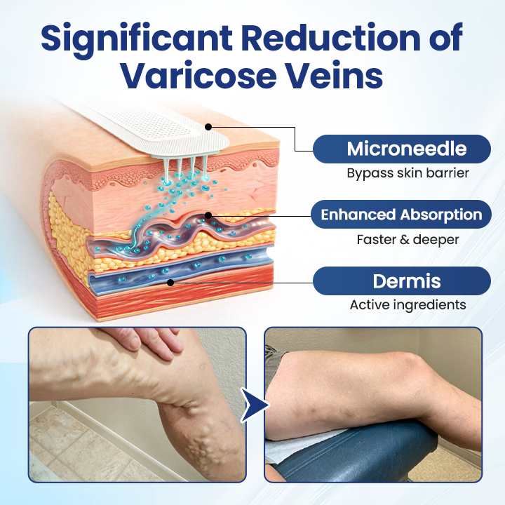 Vaxflite® Deep Vein Repair Microneedle Patch