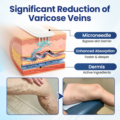 Vaxflite® Deep Vein Repair Microneedle Patch