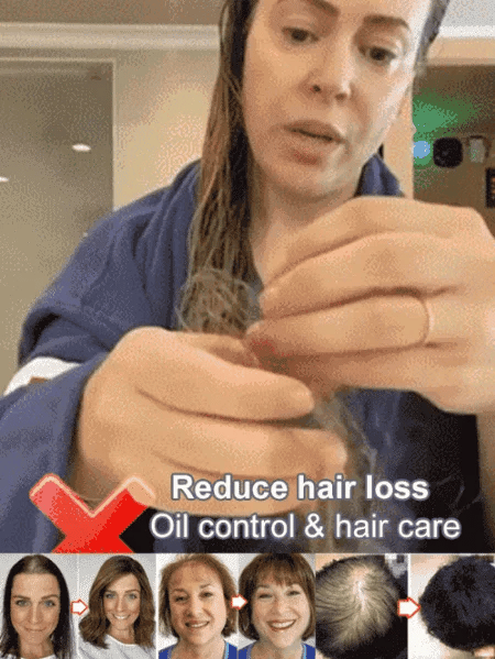 Last Day Promotio🎁Hot Sale Ginger Plant Extract Anti-Hair Loss Hair Shampoo