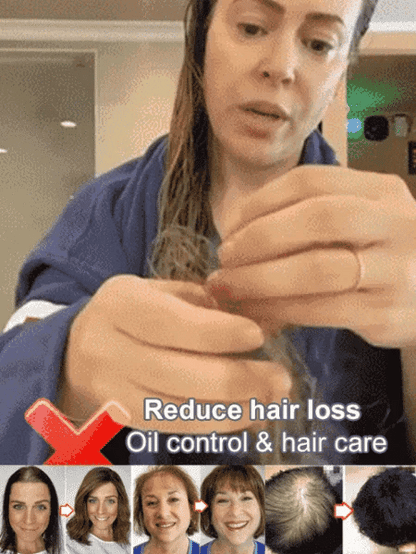 Last Day Promotio🎁Hot Sale Ginger Plant Extract Anti-Hair Loss Hair Shampoo