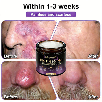 ✨Made and Shipped from USA ✨QIAWI® Biotin 10-in-1 Skin Restoration Cream 🍀
