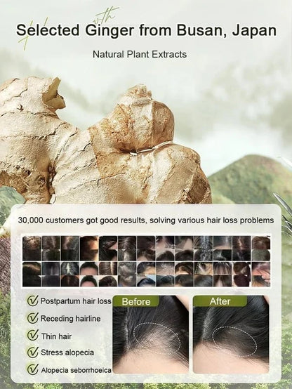 Last Day Promotio🎁Hot Sale Ginger Plant Extract Anti-Hair Loss Hair Shampoo