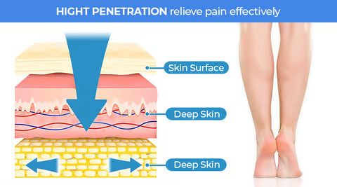 VenoRelief Everyday Leg Recovery Cream