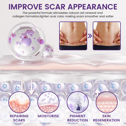 Alisanda® ReGenScar Rapid Recovery Scar Gel
