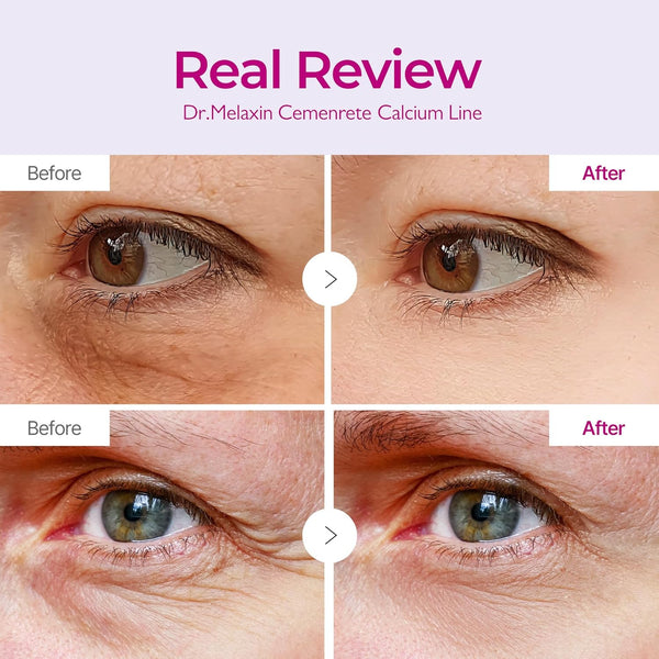 CalmRestore Calcium Eye Lift Patches