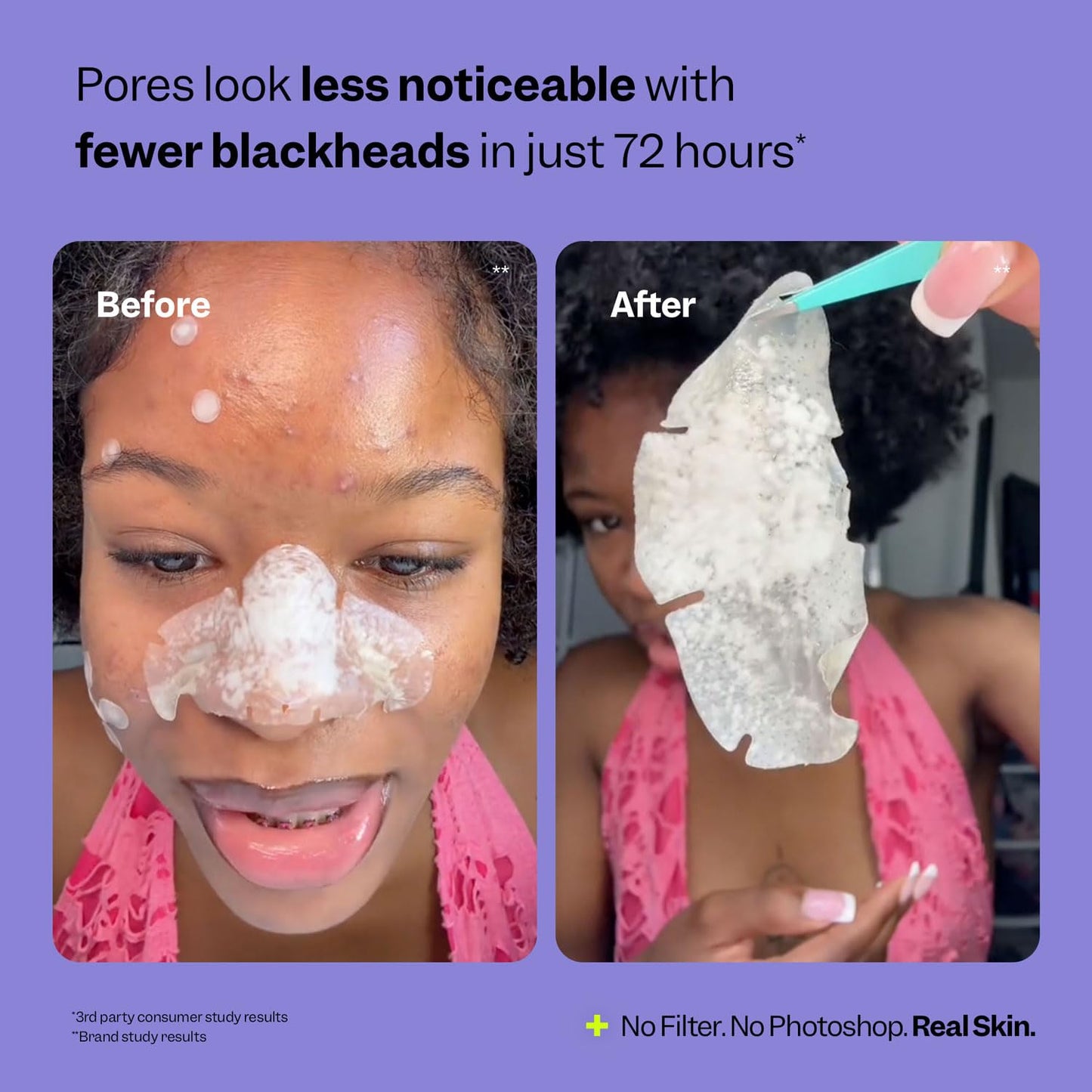Nose Pore Patches from Nexisify - Hydrocolloid Blackhead Remover Pore Strips - Overnight Pimple Patch - Korean Skincare