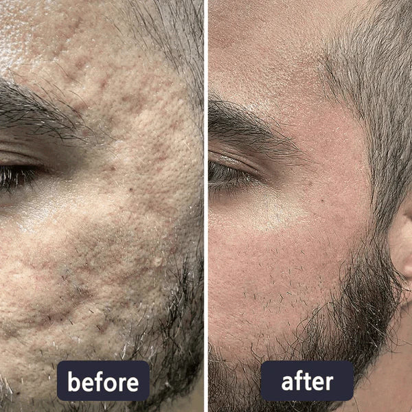 Alisanda Scar Removal Cream