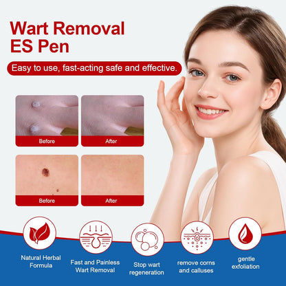 Precision Wart Remover Targeted Kit