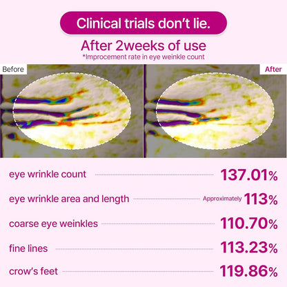CalmRestore Calcium Eye Lift Patches