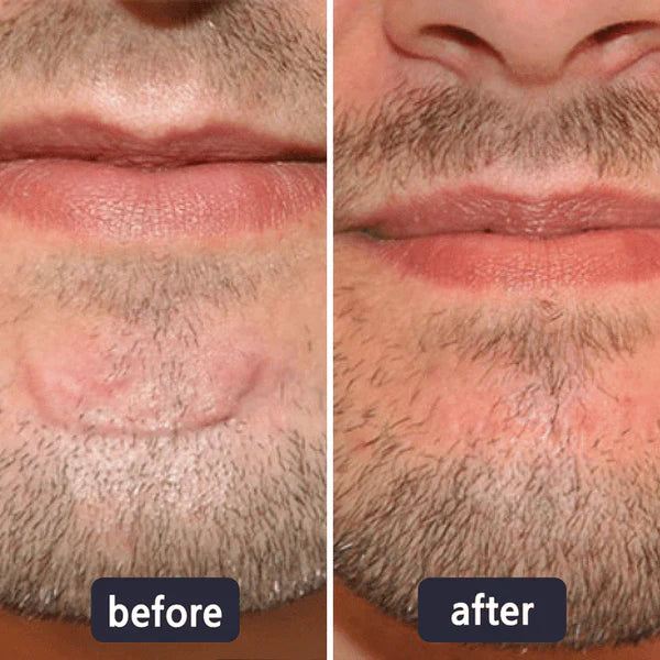 Alisanda Scar Removal Cream